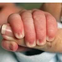 Read more about the article The Baby Reflexes
