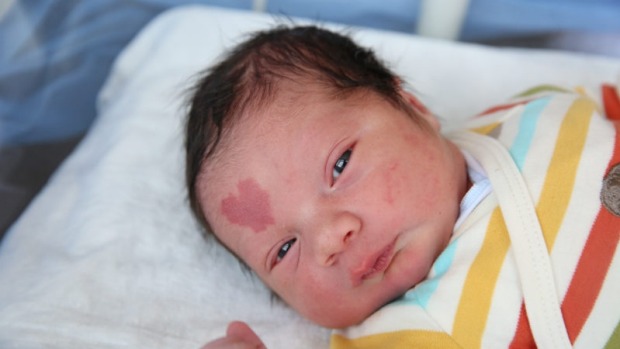 You are currently viewing ‘Love Baby’ born with super sweet birthmark,which is shaped like a love heart